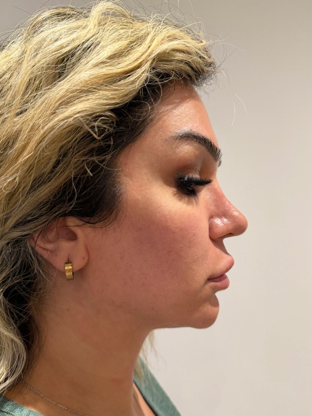 After a HydraGlass facial: smooth, clear, luminous glass skin